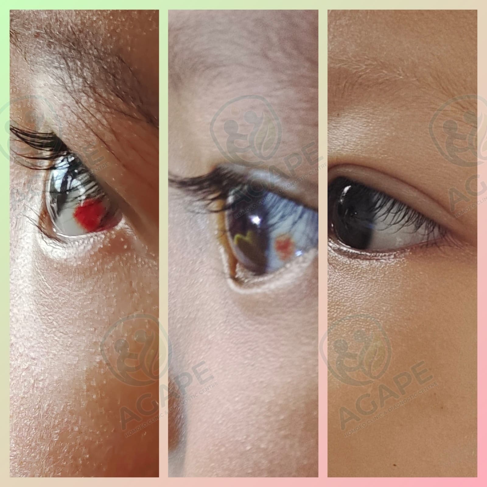 Patient recovery case