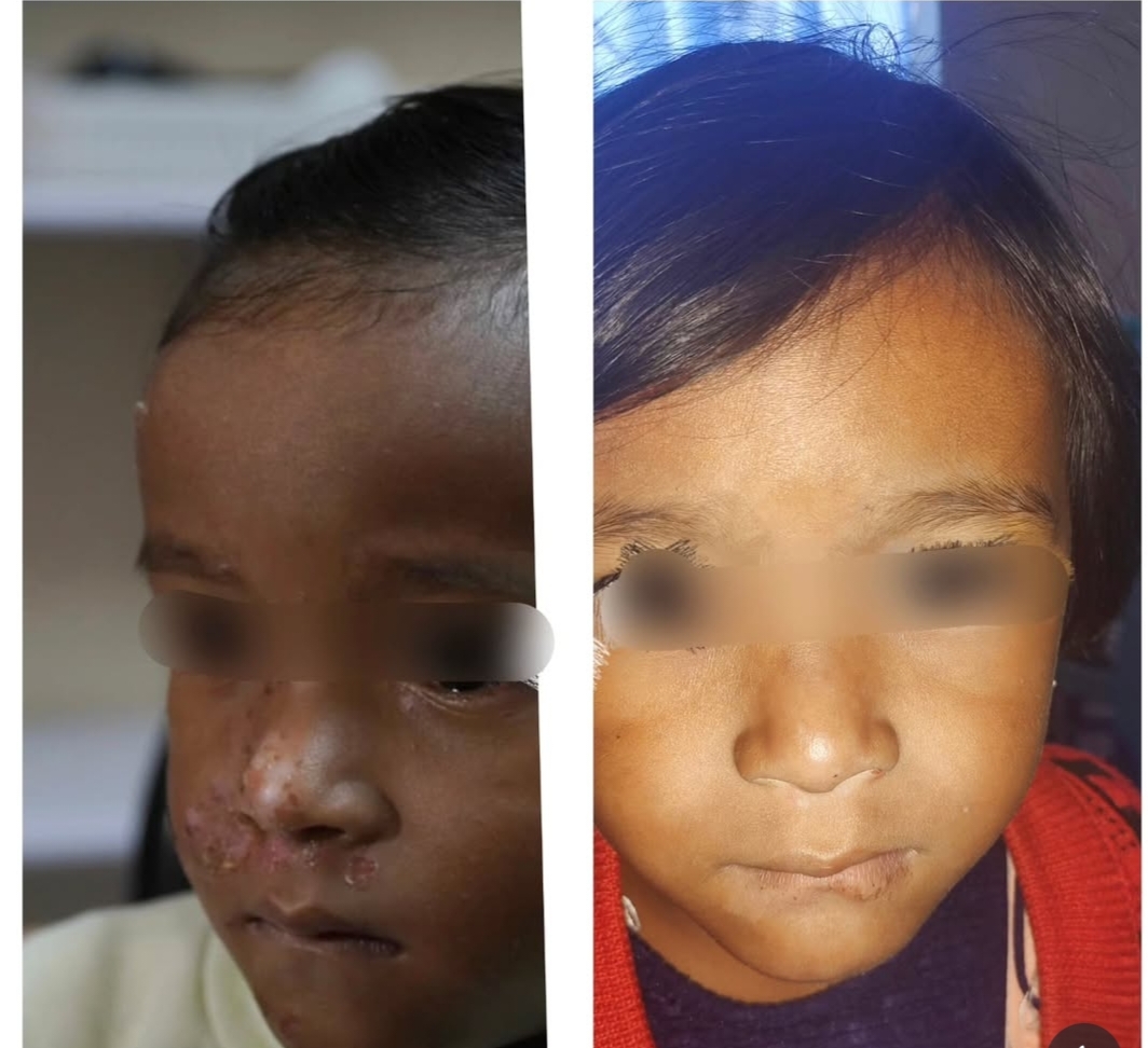 Patient recovery progress