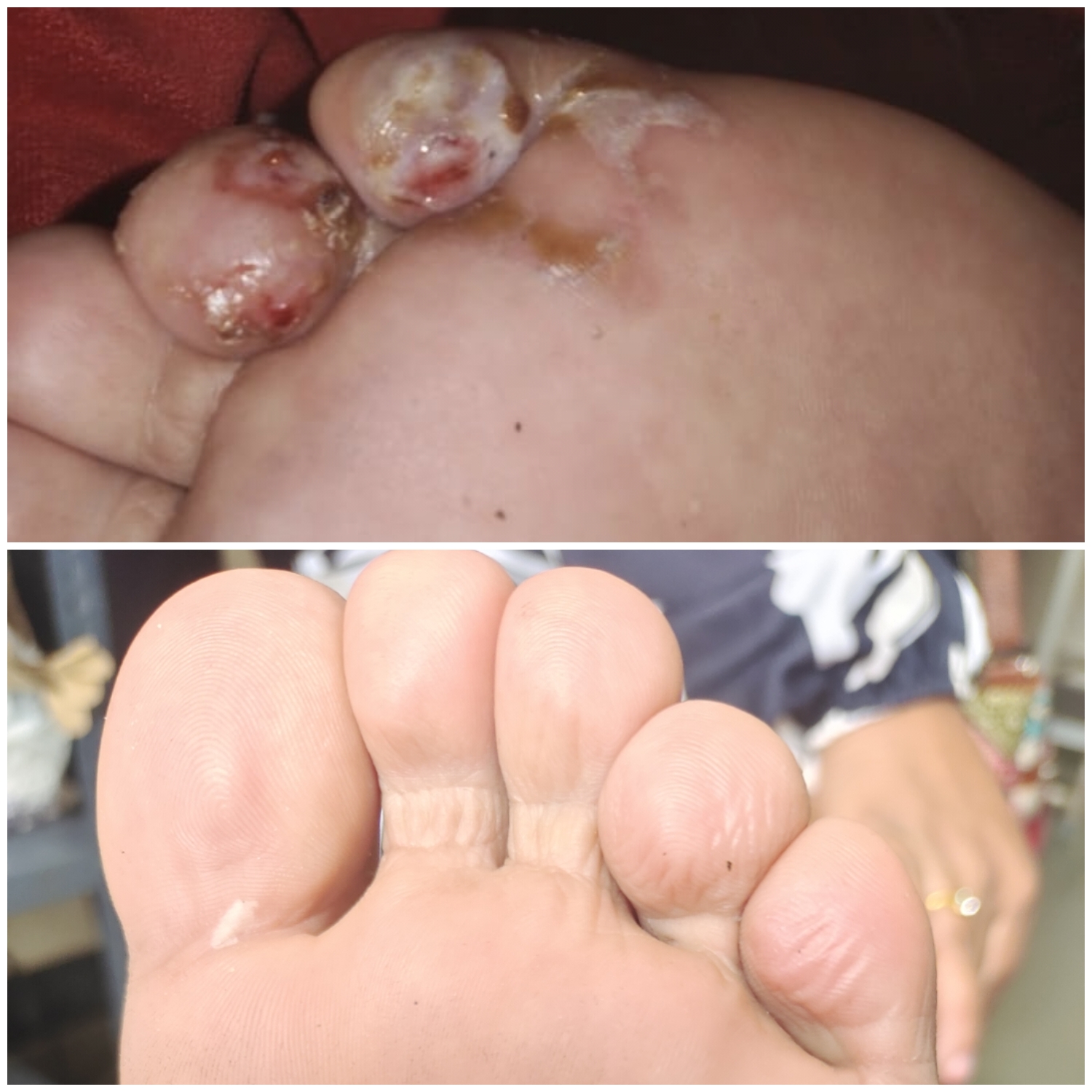 Clinical treatment case