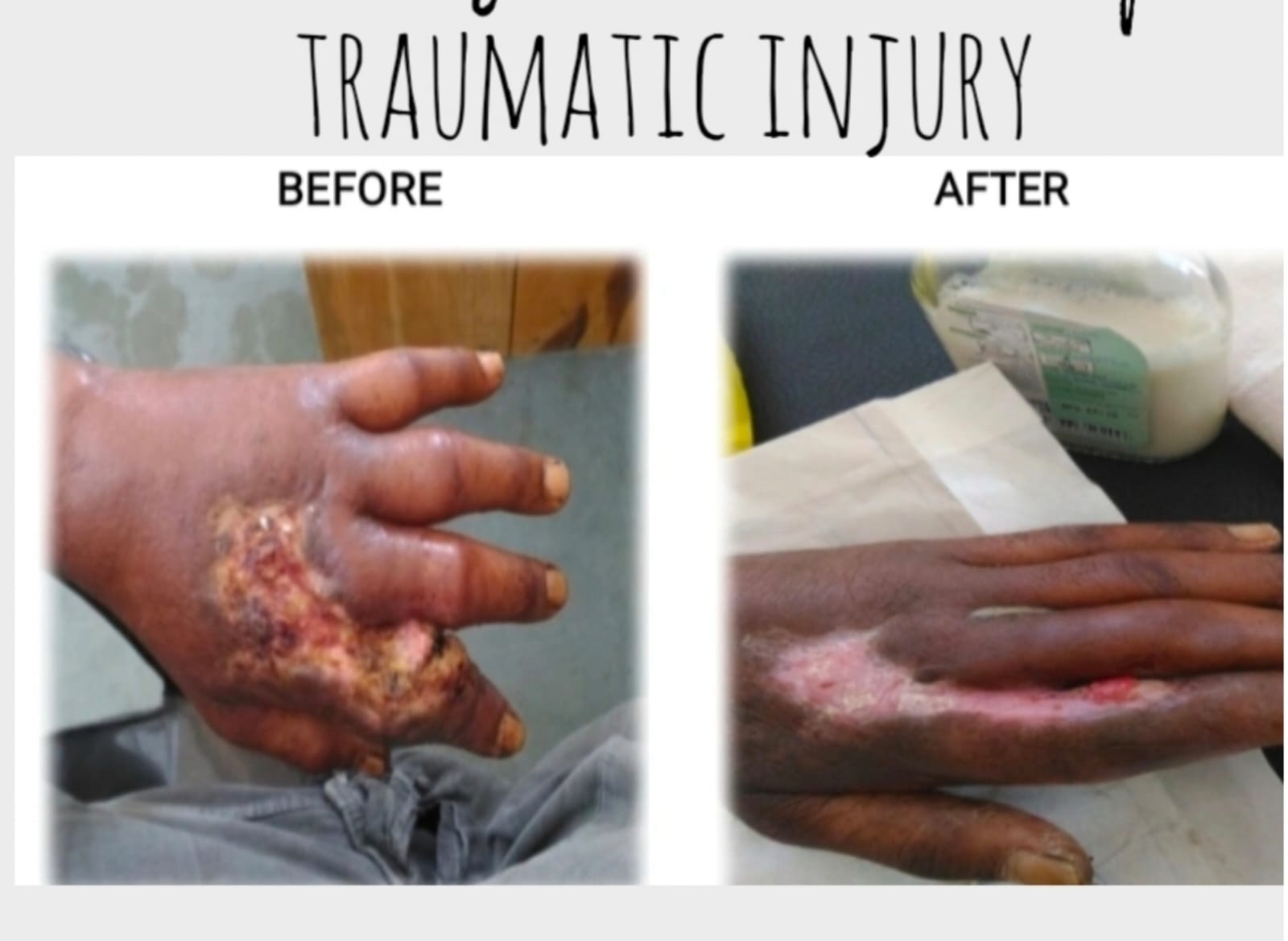 Patient treatment progress