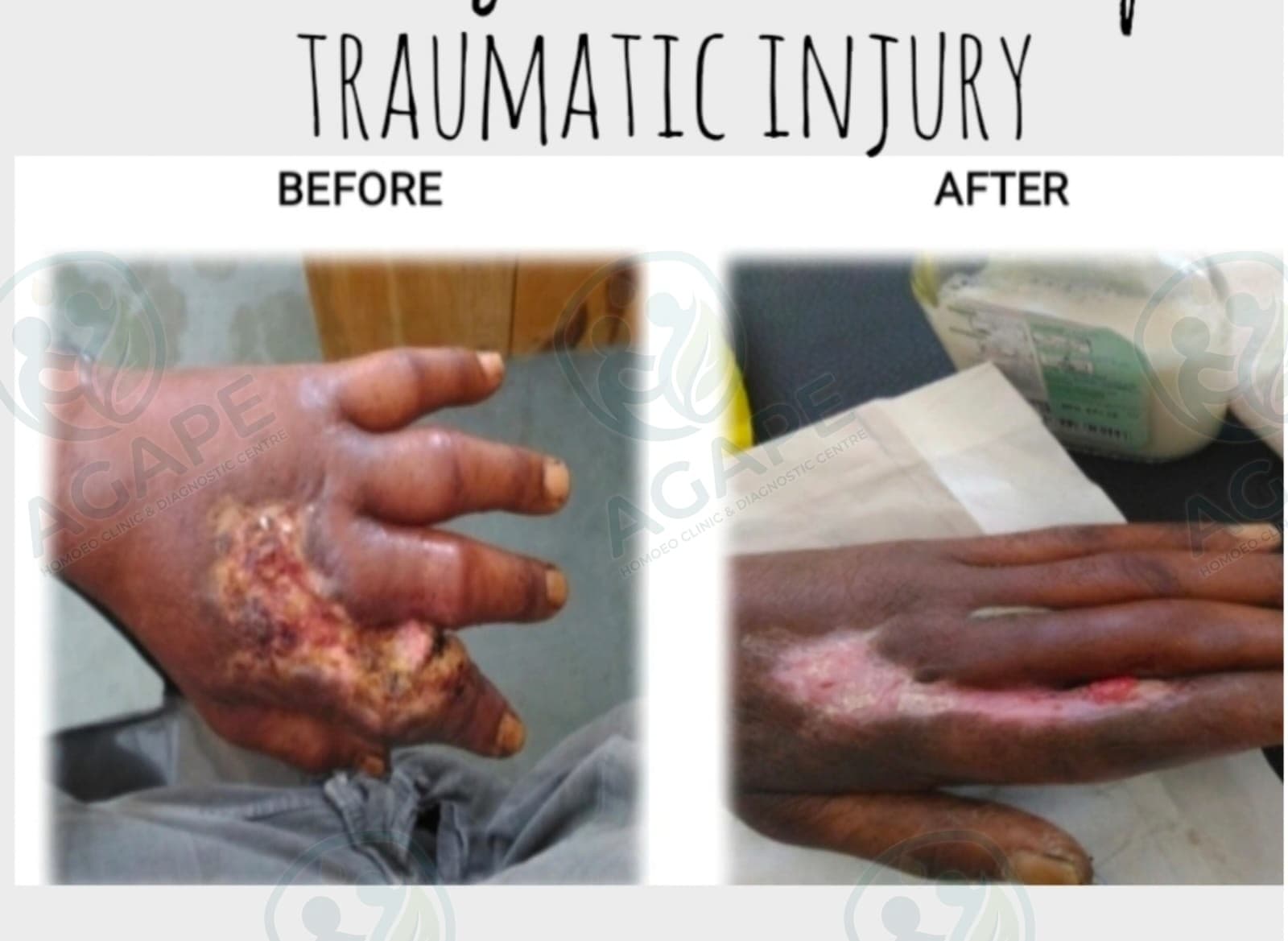 Patient treatment progress
