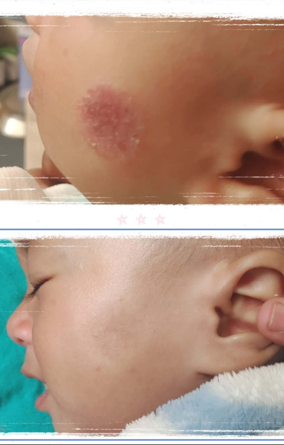 Successful treatment outcome