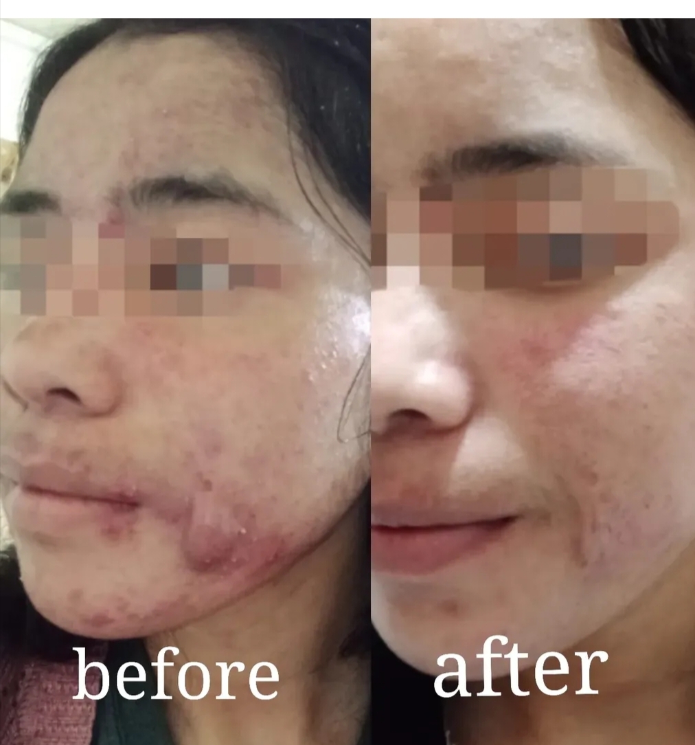 Clinical case outcome