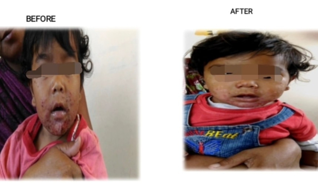 Patient testimonial case