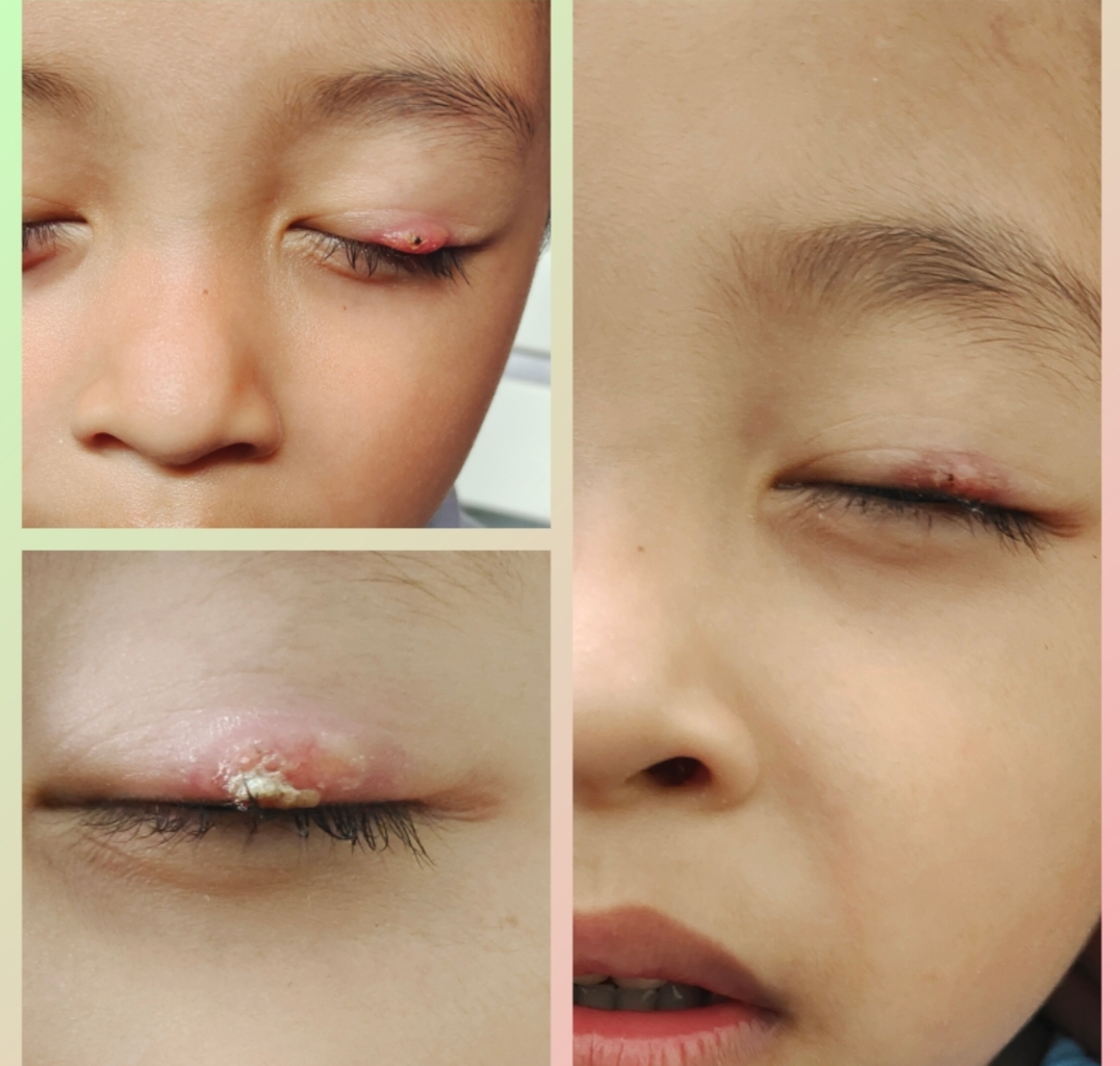 Patient treatment case
